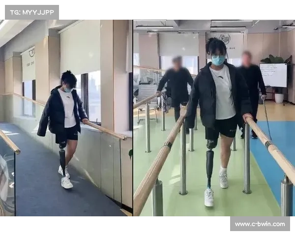 阿根廷创新自适应运动假肢获残奥委会认证 助力残疾运动员突破极限 阿根廷创新自适应运动假肢获残奥委会认证 助力残疾运动员突破极限